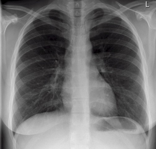 Clínica de Cardiologia para Tratar Insuficiência Cardíaca Caieiras - Clínica de Cardiologia para Tratar Arritmias