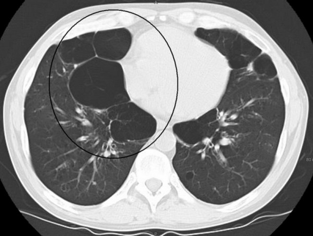 Clínica de Pneumologia Particular ARUJÁ - Clínica Médica com Pneumologia