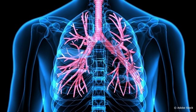 Clínica Médica com Pneumologia Itu - Clínica de Pneumologia para Tratar Bronquite