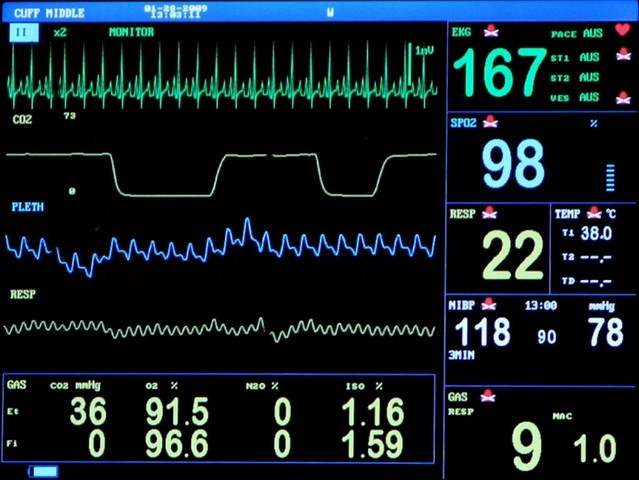 Consulta ao Cardiologia para Tratamento de Arritmias Americana - Consulta ao Cardiologia para Infarto Agudo do Miocárdio