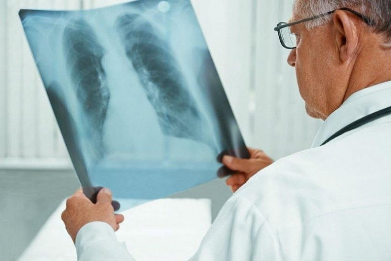 Consulta Pneumologista para Bronquite Asmática Salesópolis - Consulta ao Pneumologista para Pneumonia