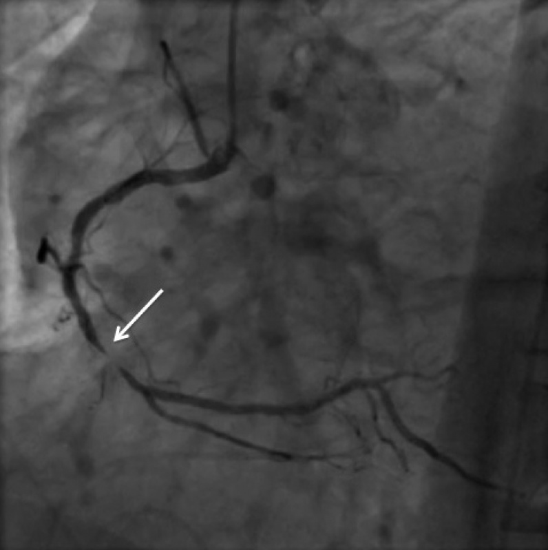 Onde Encontrar Clínica de Cardiologia para Tratar Angina Mairiporã - Clínica Particular de Cardiologia