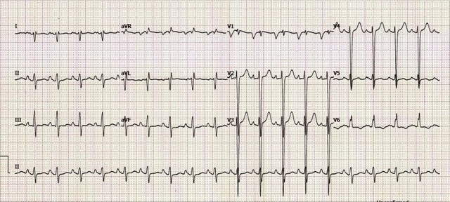 Onde Encontrar Clínica de Cardiologia para Tratar Miocardites Mairiporã - Clínica de Cardiologia Particular