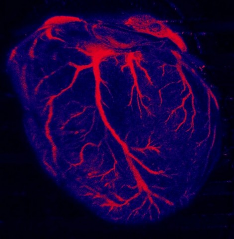 Onde Encontrar Clínica de Cardiologista Guararema - Clínica de Cardiologia para Tratar Miocardites