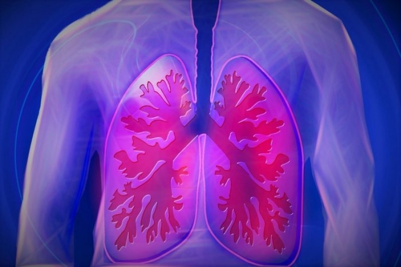 Onde Encontrar Clínica de Pneumologia para Tratar Bronquite Vale do Paraíba - Clínica de Pneumologia para Tratar Apneia