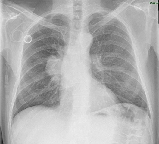 Onde Encontrar Consulta ao Pneumologista para Tosse Diadema - Consulta ao Pneumologista para Tosse Seca