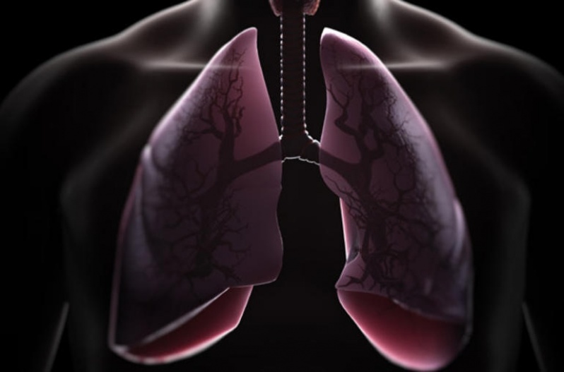 Onde Encontrar Consulta Pneumologista para Bronquite Jandira - Consulta ao Pneumologista para Pneumonia