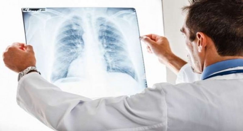 Onde Encontrar Consulta Pneumologista para Tratar Bronquite Vargem Grande Paulista - Consulta ao Pneumologista para Pneumonia