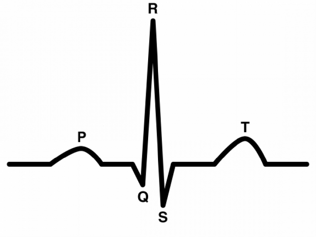 Onde Encontro Clínica de Cardiologia para Tratar Arritmias Osasco - Clínica Particular de Cardiologia