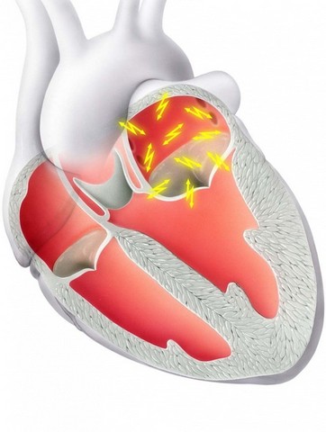 Onde Encontro Clínica de Cardiologia para Tratar Doenças Cardíacas Cajamar - Clínica de Cardiologia para Tratar Arritmias
