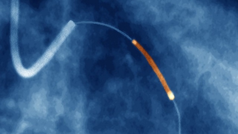 Onde Encontro Clínica de Cardiologia para Tratar Infarto Ribeirão Preto - Clínica de Cardiologia para Tratar Miocardiopatia