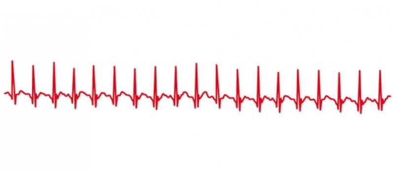 Onde Encontro Clínica de Cardiologia para Tratar Miocardites Caieiras - Clínica de Cardiologia Particular