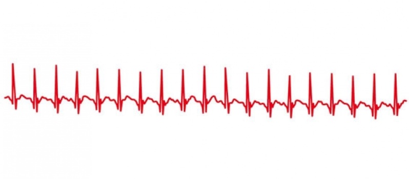 Onde Encontro Clínica de Cardiologia para Tratar Miocardites Embu das Artes - Clínica de Cardiologia para Tratar Miocardiopatia