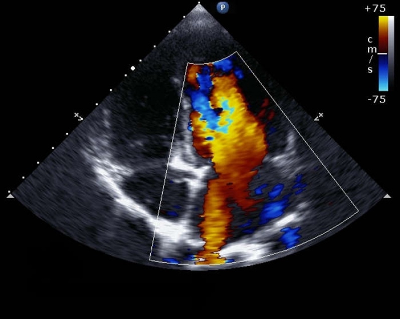 Quanto Custa Check Up Cardiológico para Homens Santana de Parnaíba - Check Up Cardiológico para Atividades Esportivas