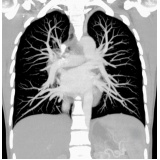 clínica com médico pneumologista Votuporanga