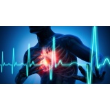clínica de cardiologia para tratar infarto Hortolândia