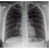 clínica de cardiologia para tratar insuficiência cardíaca Mendonça