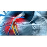 clínica de cardiologia para tratar miocardiopatia Araras
