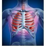clínica de pneumologia para bronquite asmática Salesópolis