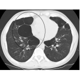 clínica de pneumologia particular Araraquara