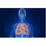 clínica para tratamento para dpoc Campinas