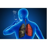 clínica para tratamento para fumo Barueri