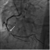 clínica de cardiologia para tratar angina