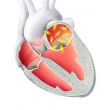 clínica de cardiologia para tratar doenças cardíacas