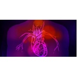 clínica de cardiologia para tratar miocardiopatia