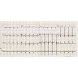 clínica de cardiologia para tratar miocardites