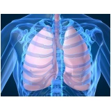 clínicas de pneumologista para derrame pleural