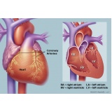 consulta ao cardiologia para infarto agudo do miocárdio Marapoama