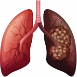 consulta no pneumologista ABCD