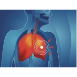 consulta pneumologista para bronquite ABCD