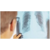 consulta pneumologista para tratar asma Araçatuba