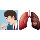 consulta pneumologista para tratar enfisema pulmonar Marapoama