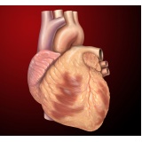 consulta ao cardiologia para angina
