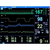 Consulta ao Cardiologia para Tratamento de Arritmias