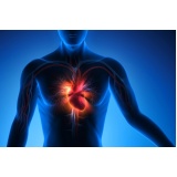 consulta ao cardiologia para tratamento de infarto