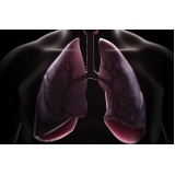 consulta pneumologista para bronquite