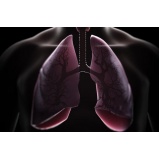 Consulta Pneumologista para Bronquite