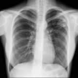 médico pneumologistas para tratar doenças pulmonares em sp Diadema