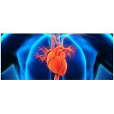 cardiologista para tratar miocardiopatia