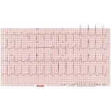 cardiologista para tratar pericardites