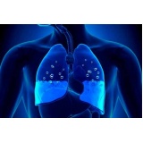 pneumologista para tratar água no pulmão