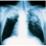 pneumologista particular