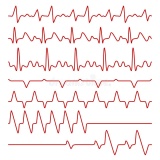 onde encontrar cardiologista especialista em arritmias Ribeirão Pires