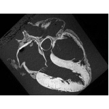 onde encontrar cardiologista para tratar miocardiopatia Vale do Paraíba