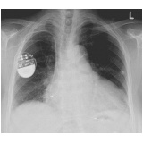 onde encontrar cardiologista para tratar miocardites Ribeirão Preto