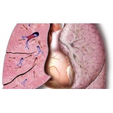 onde encontrar clínica de pneumologia para tratar embolia pulmonar ABCD